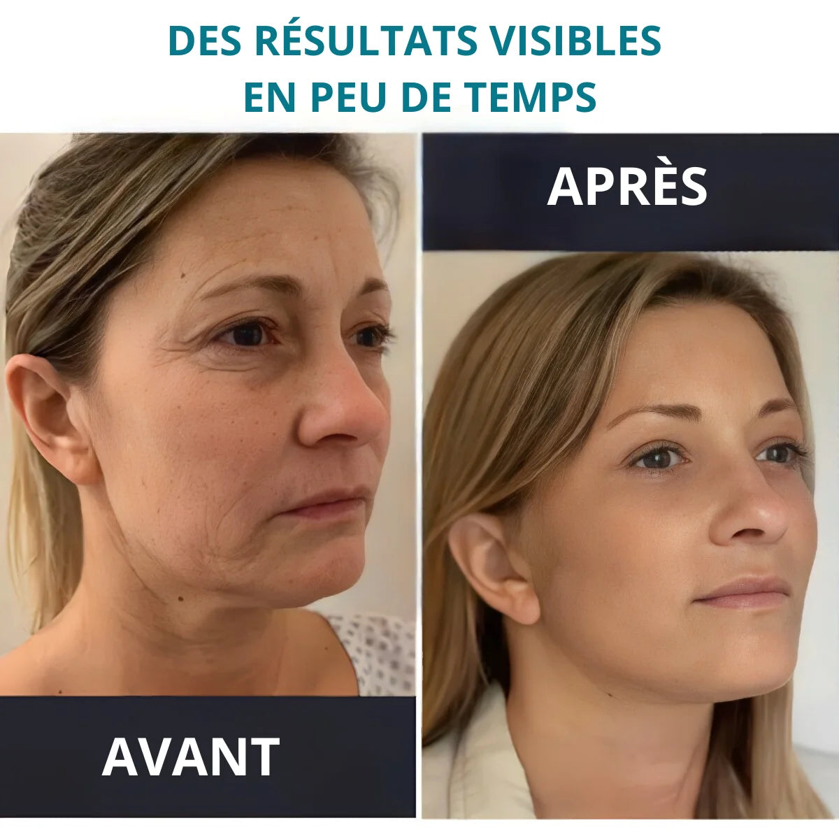 Crème Lissante Japonaise