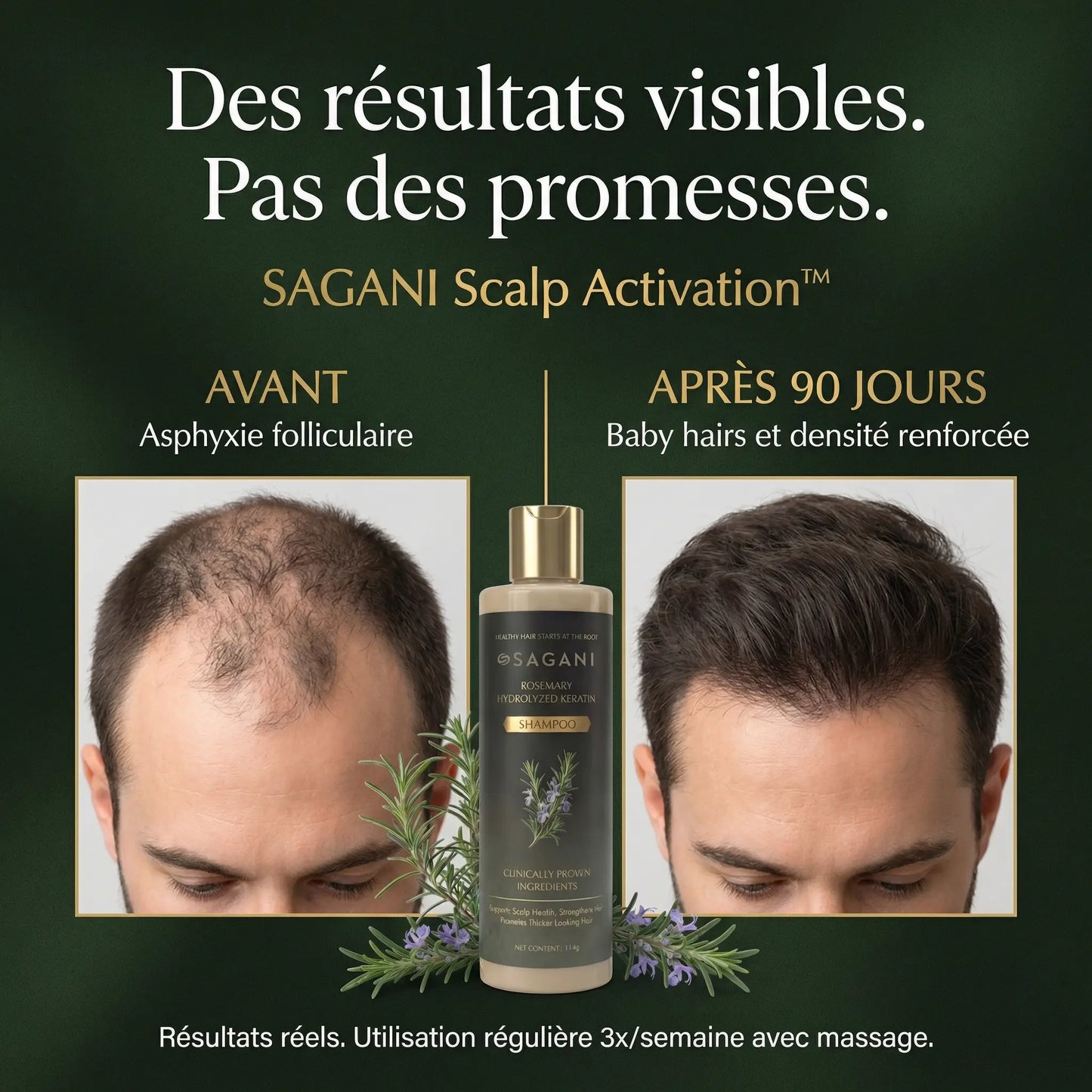 Scalp Activation - Sagani™