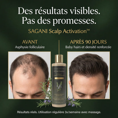 Scalp Activation - Sagani™