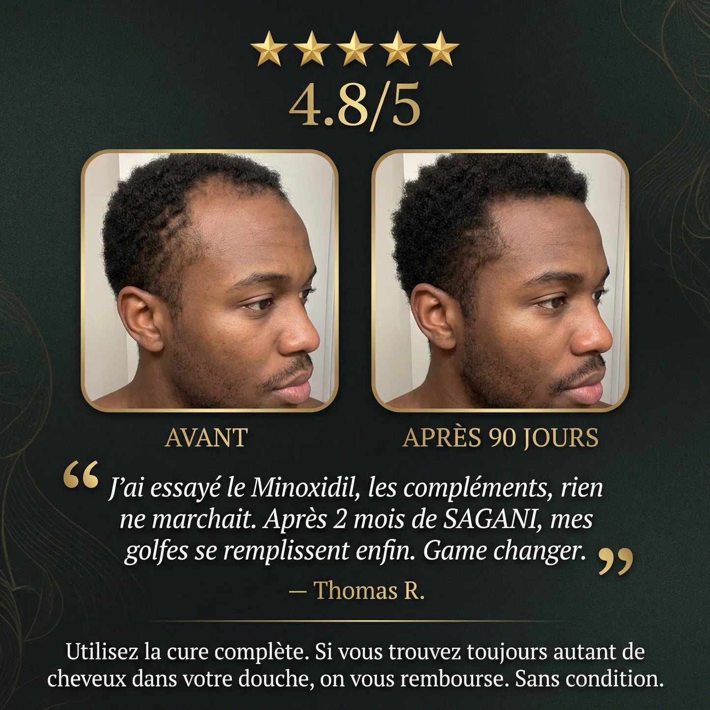 Scalp Activation - Sagani™