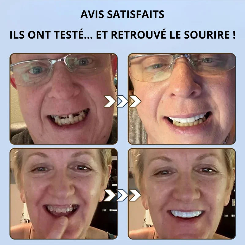 Prothèse Dentaire Complète