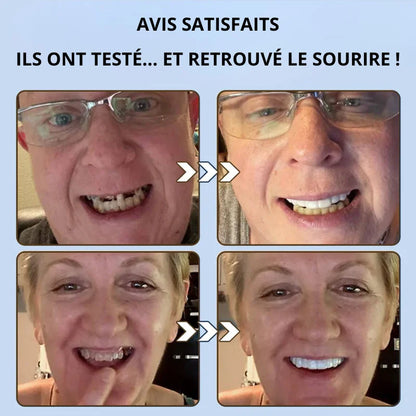 Prothèse Dentaire Complète