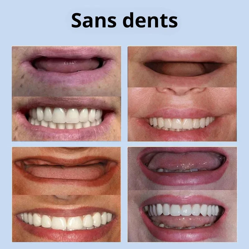 Prothèse Dentaire Complète