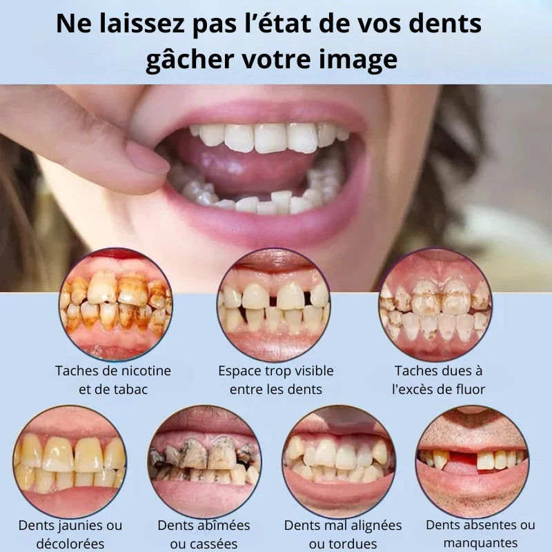 Prothèse Dentaire Complète